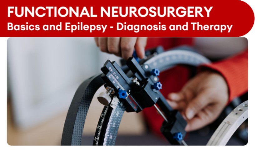 Read more about the article Functional Neurosurgery | ENTraining Academy | Academy Course 3 |Basic knowledge of functional neurosurgery and Epilepsy – Diagnosis and Therapy